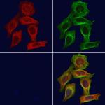 IL18BP Polyclonal Antibody