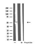 IFIT5 Antibody in Western Blot (WB)