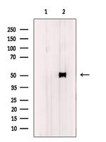 Cytokeratin 37/38 Polyclonal Antibody