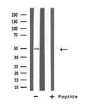 Cytokeratin 37/38 Antibody in Western Blot (WB)