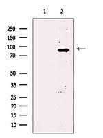 PLA2G6 Polyclonal Antibody