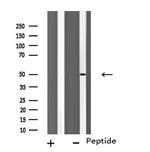 TUBA3C/TUBA3E Antibody in Western Blot (WB)