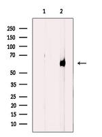 CYP4V2 Polyclonal Antibody