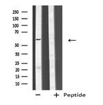 CYP4V2 Antibody in Western Blot (WB)