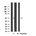 CYP3A7 Antibody in Western Blot (WB)