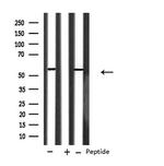 CYP2A6 Polyclonal Antibody