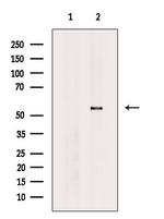 CYP39A1 Antibody in Western Blot (WB)