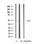 CK1 delta Antibody in Western Blot (WB)