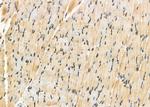 CK1 delta Antibody in Immunohistochemistry (Paraffin) (IHC (P))