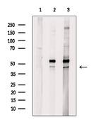 CK1 delta Antibody in Western Blot (WB)