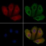 STK33 Polyclonal Antibody