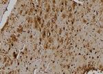 STK33 Antibody in Immunohistochemistry (Paraffin) (IHC (P))