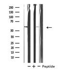 STK33 Antibody in Western Blot (WB)