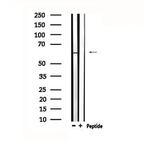 TESK2 Polyclonal Antibody