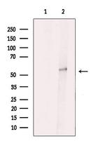 VRK3 Polyclonal Antibody