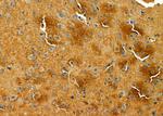 LRP8 Polyclonal Antibody