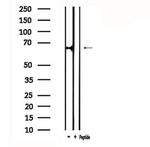 ATG16L2 Polyclonal Antibody