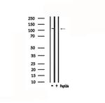 Desmoglein 1 Polyclonal Antibody