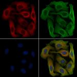 GPR151 Polyclonal Antibody