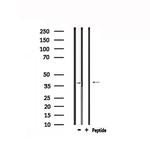 TPRA1 Polyclonal Antibody