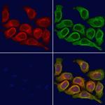 GPR37L1 Polyclonal Antibody