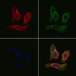 GPR35 Polyclonal Antibody