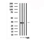 GPR35 Antibody in Western Blot (WB)