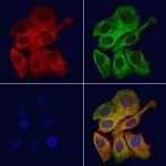 mPR gamma Polyclonal Antibody