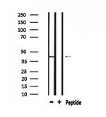 mPR gamma Antibody in Western Blot (WB)