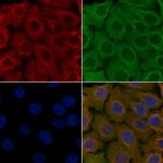 SCTR Polyclonal Antibody