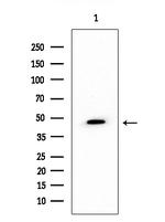 SCTR Antibody in Western Blot (WB)