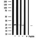 BAK Polyclonal Antibody