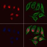 ARNT Antibody in Immunocytochemistry (ICC/IF)