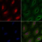 ARNT Polyclonal Antibody