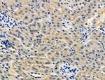 STAR Polyclonal Antibody