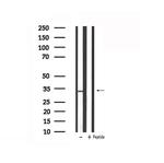 STAR Antibody in Western Blot (WB)