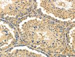 Endothelin 3 Polyclonal Antibody