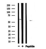 ALPL Polyclonal Antibody