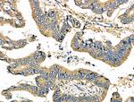 C19orf10 Polyclonal Antibody