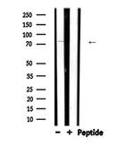 ARHGEF7 Polyclonal Antibody