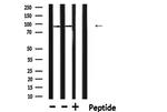 E2F8 Antibody in Western Blot (WB)