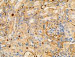 RALBP1 Antibody in Immunohistochemistry (Paraffin) (IHC (P))