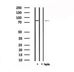 TRIF Polyclonal Antibody
