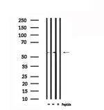 STIP1 Polyclonal Antibody