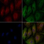 CGA Polyclonal Antibody