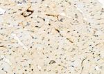 CGA Antibody in Immunohistochemistry (Paraffin) (IHC (P))