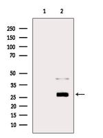 Trypsin Antibody in Western Blot (WB)