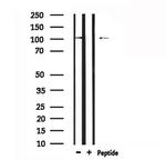 DPYD Polyclonal Antibody