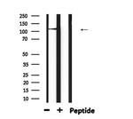 DPYD Antibody in Western Blot (WB)