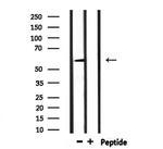 UGT1A9 Polyclonal Antibody